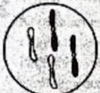 Image for option B