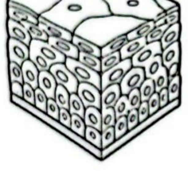 Image for option A