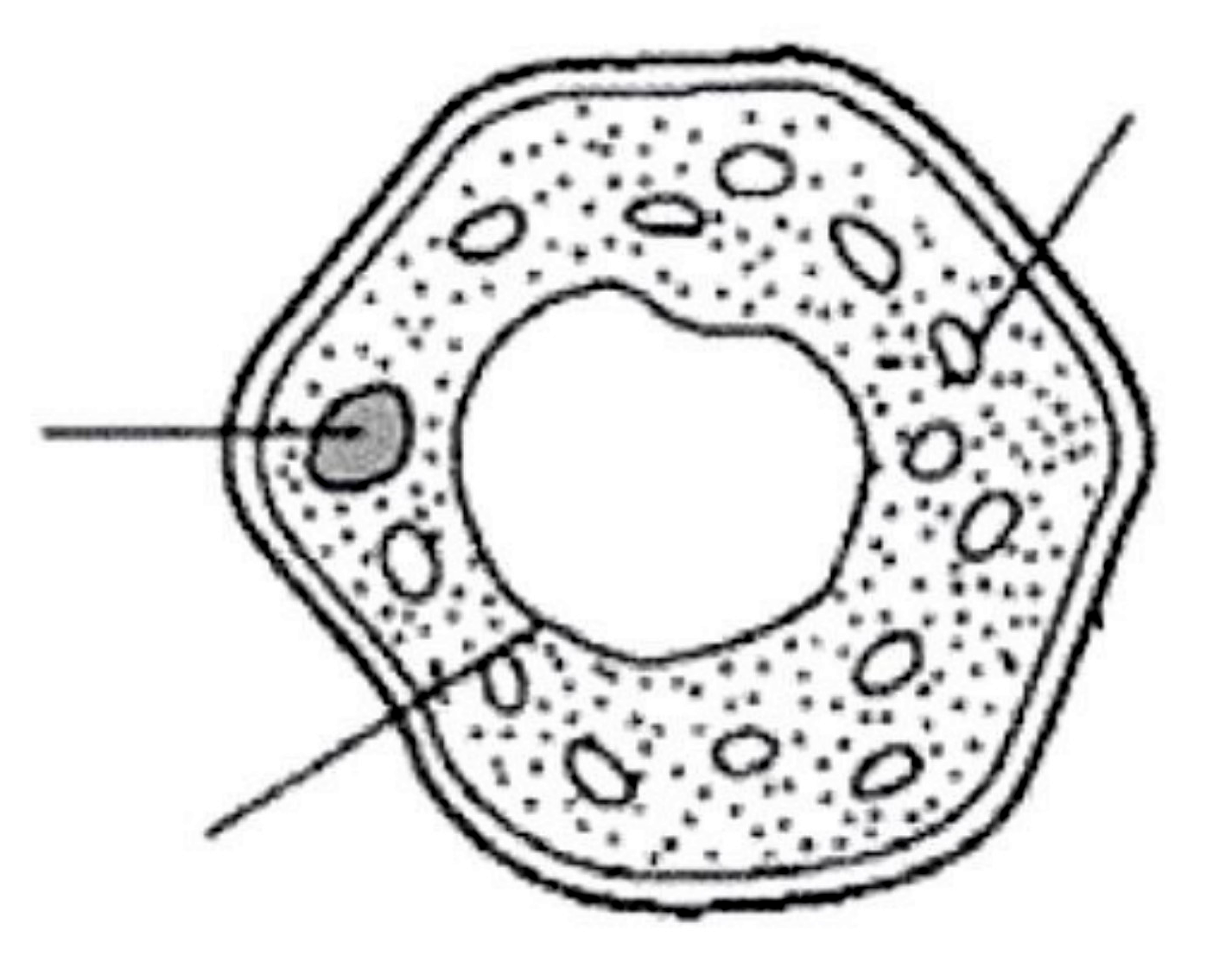 Image for option D