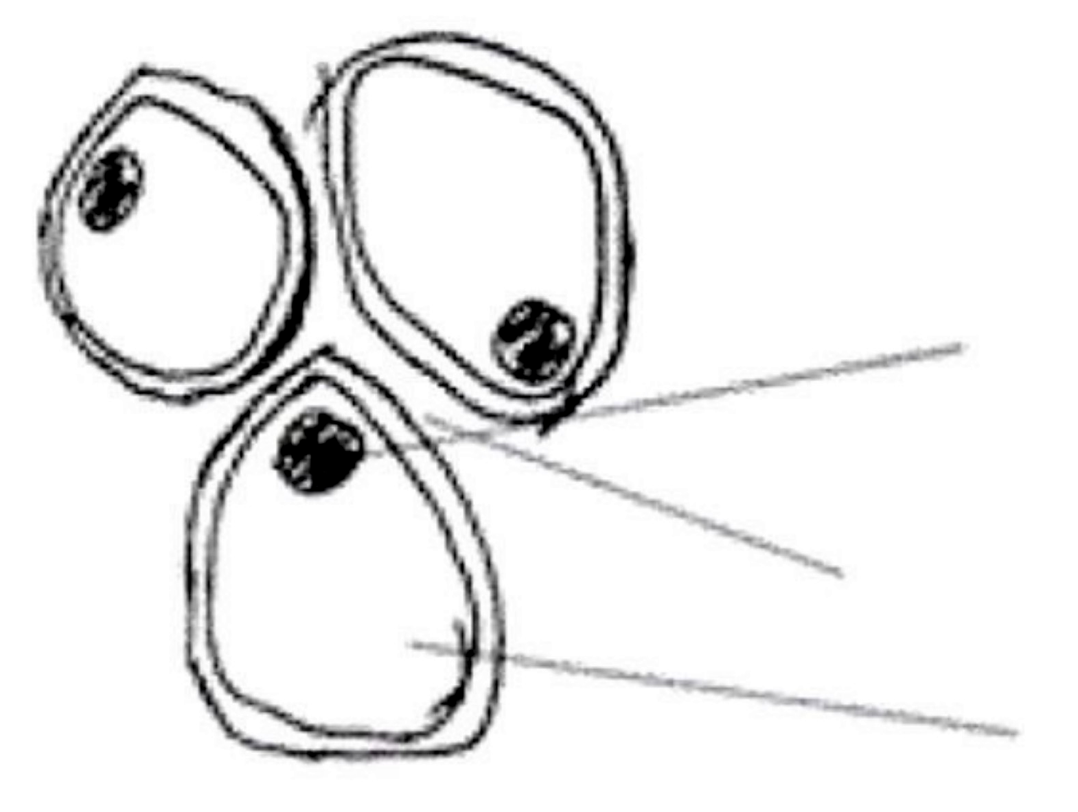 Image for option B
